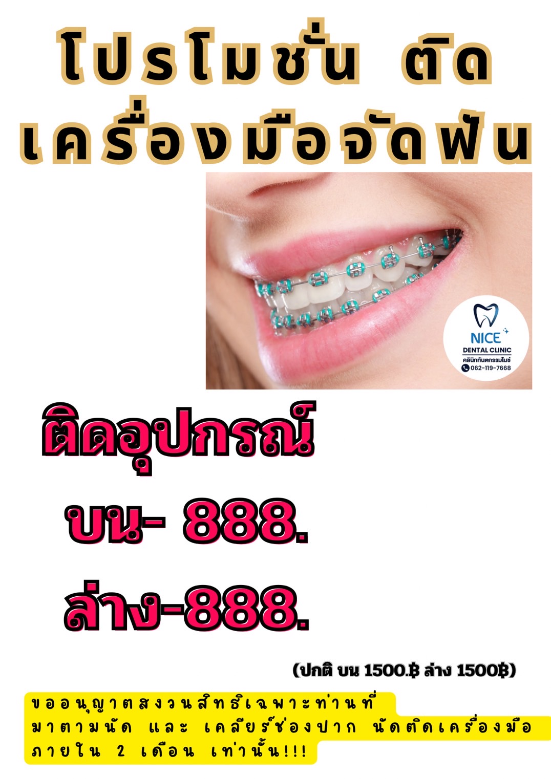 โปร ดัดฟัน