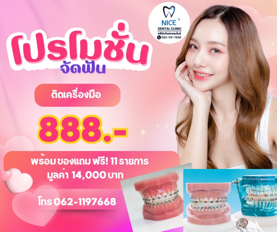 โปรจัดฟัน 888